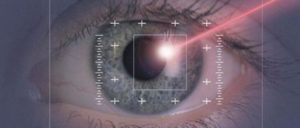 Laser oculistica