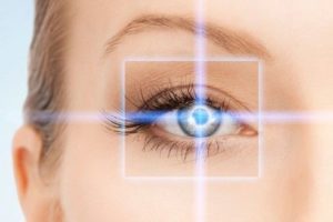 laser miopia oculista