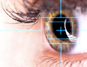 Intervento cataratta-laser